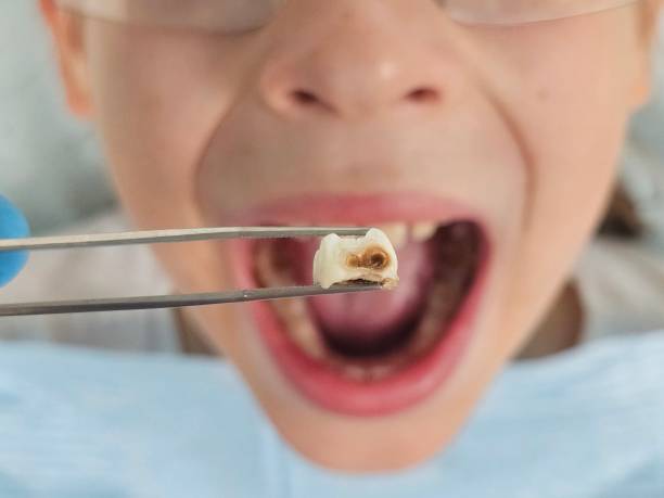 Best Orthodontic Emergency Dentist in Laurium, MI