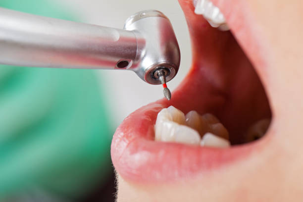 Best Pediatric Emergency Dentist in Laurium, MI